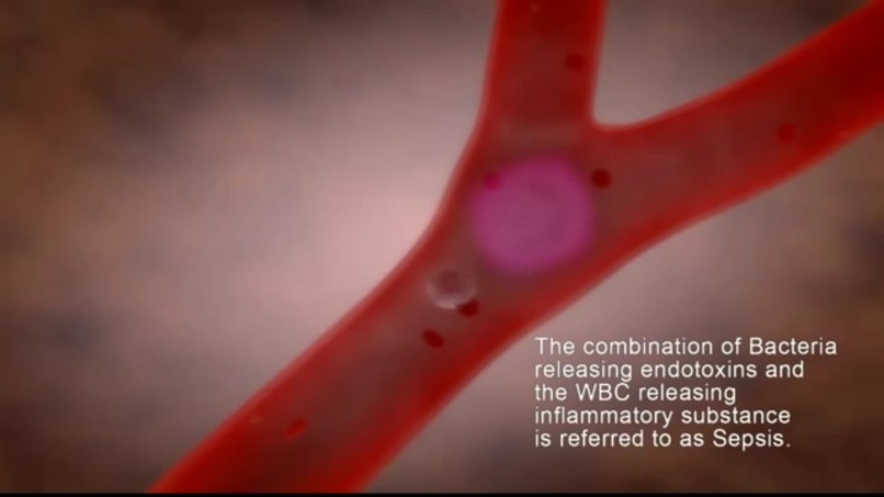 sepsis predictor – screenshot 2