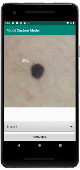 melanoma model – screenshot 2