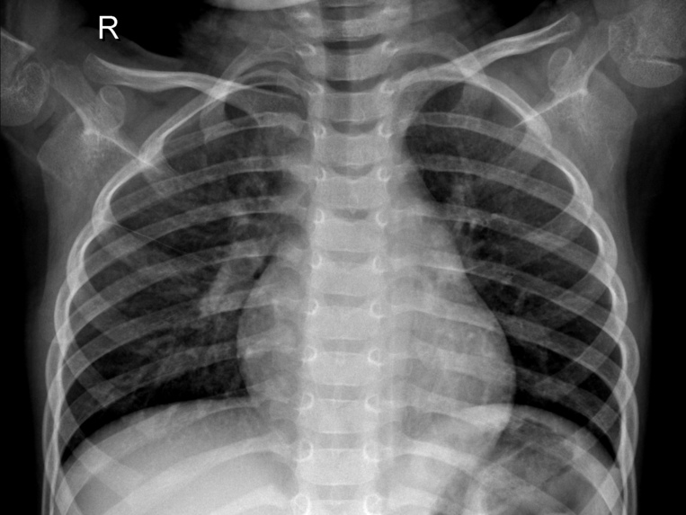 Triage Optimiser for Pneumonia Detection – screenshot 1