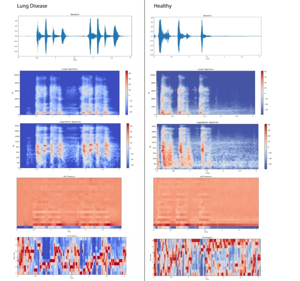 1-020-Corona-Testprozesse-COVtest_CORONA_Test_mit_KI – screenshot 5