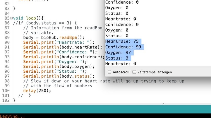 01_006_Medizingeräteherstellung_DIY-Beatmungsgerät  – screenshot 11