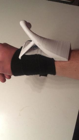 1_028_b_kreativer_gesundheitsschutz_HandsFreeTüröffner – screenshot 3