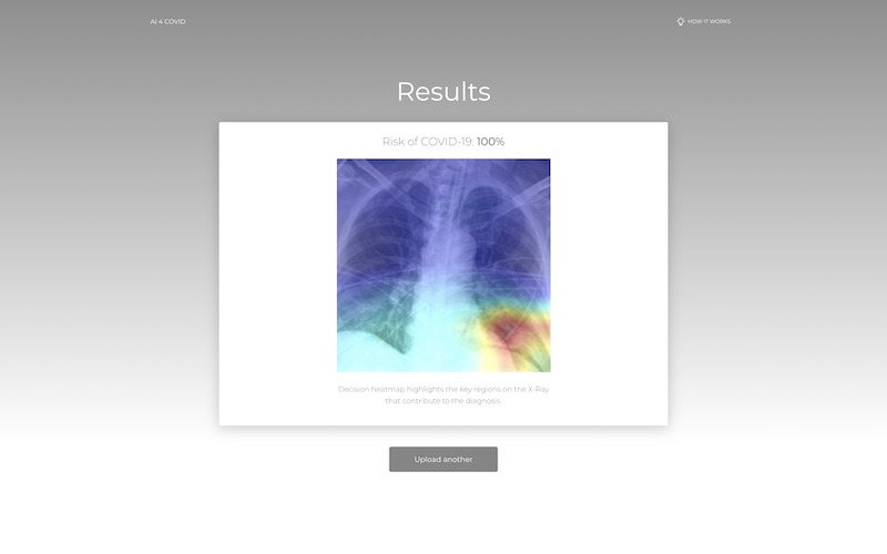 AI_4_COVID – screenshot 2