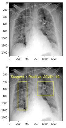 COVID-19-Detection-Device – screenshot 1
