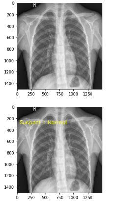 COVID-19-Detection-Device – screenshot 2