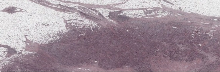 COVID19 Digital Pathology Database – screenshot 1