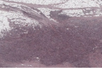 COVID19 Digital Pathology Database