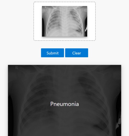 Pneumonia Detection – screenshot 2