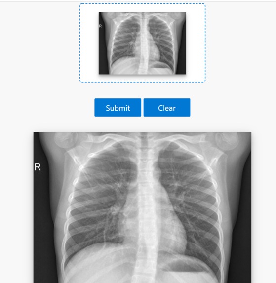 Pneumonia Detection – screenshot 4