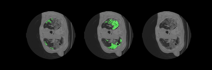 Covid-19 Medical Segmentation – screenshot 4