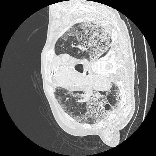 Covid-19 Medical Segmentation – screenshot 3