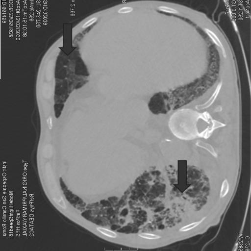 Covid-19 Medical Segmentation – screenshot 5