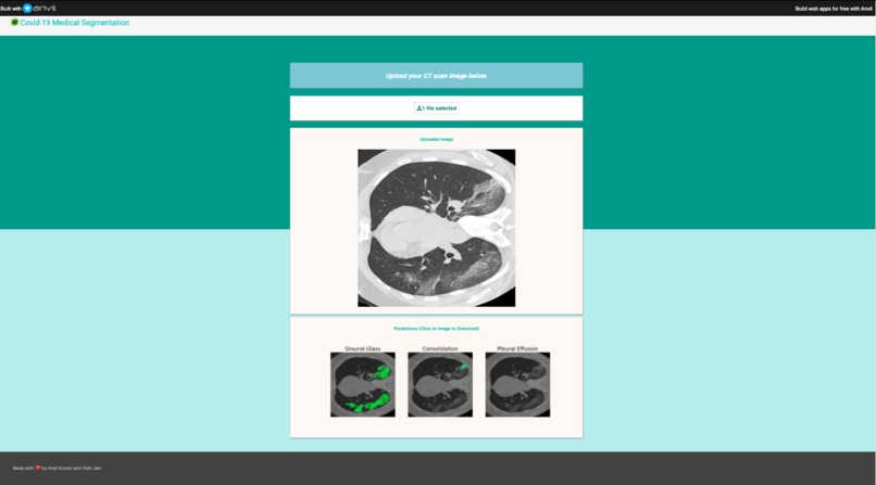 Covid-19 Medical Segmentation – screenshot 2