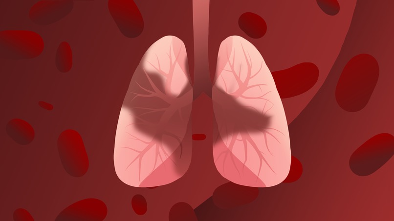 Cure Inc – screenshot 2