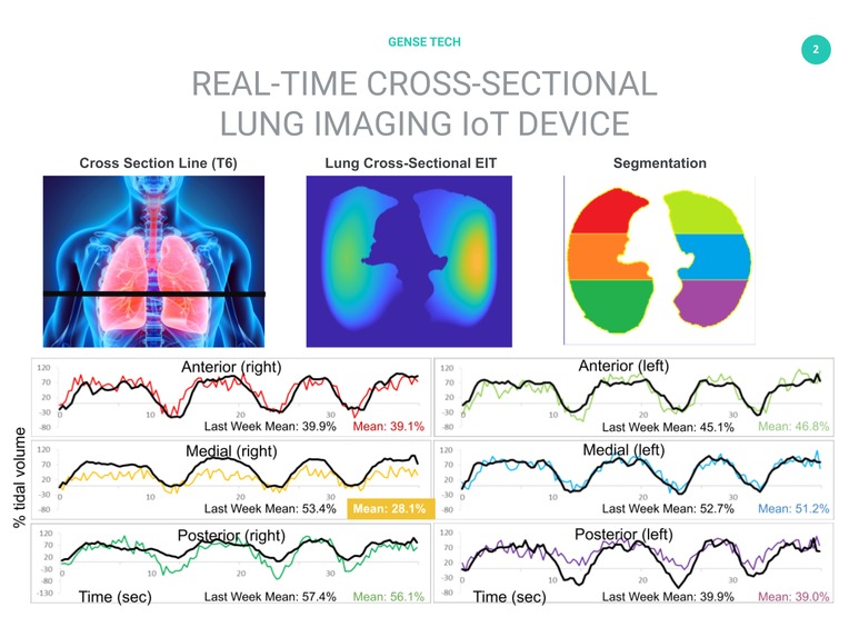 Lung imaging IoT for remote monitoring in isolation – screenshot 1