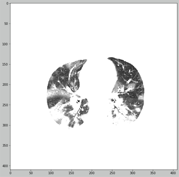 Automated classification for COVID-19 pneumonia – screenshot 1