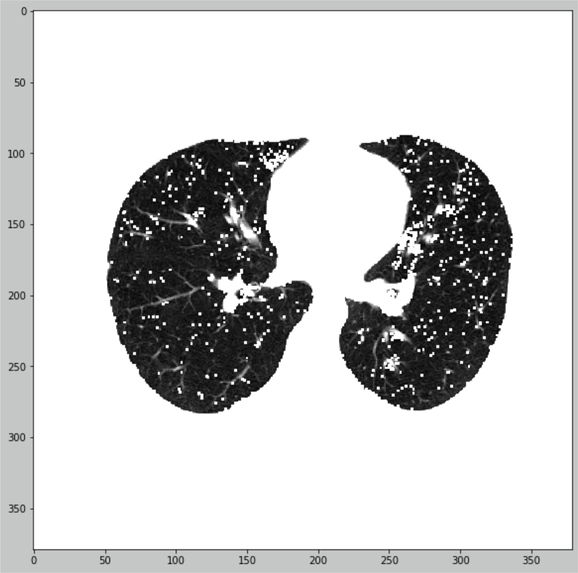 Automated classification for COVID-19 pneumonia – screenshot 3