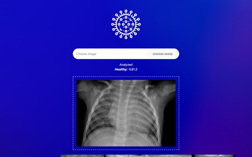 T-Covid: A Fast COVID-19 Diagnosis Tool – screenshot 1