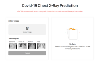 SC2-Net / Covid-19 X-Ray Detector