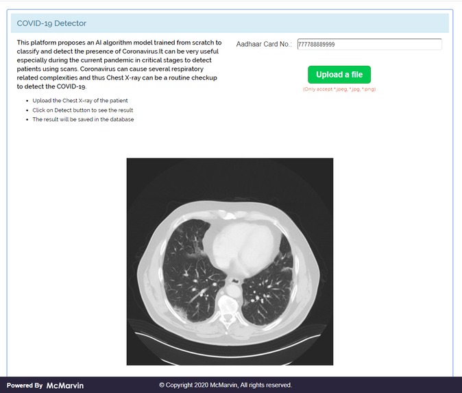 COVID - 19 AI Diagnosis Platform – screenshot 6