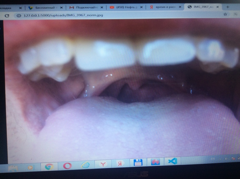 Covid19FlaskServer – screenshot 1