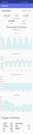 OpenVentSmartApplication – screenshot 4