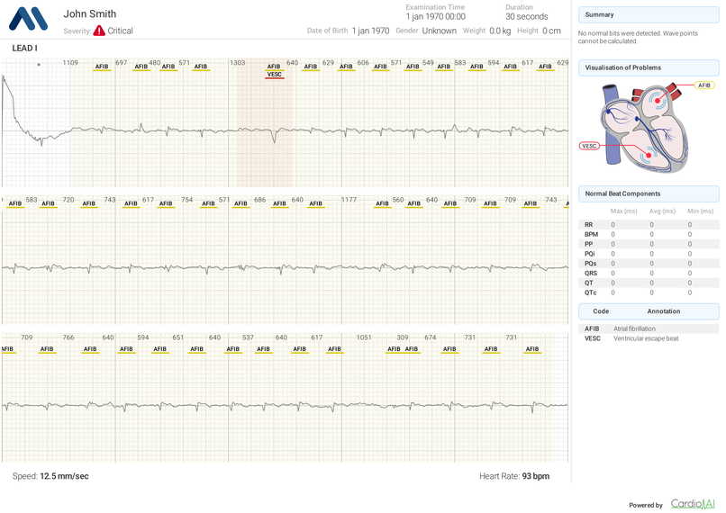 Cardio.AI – screenshot 1