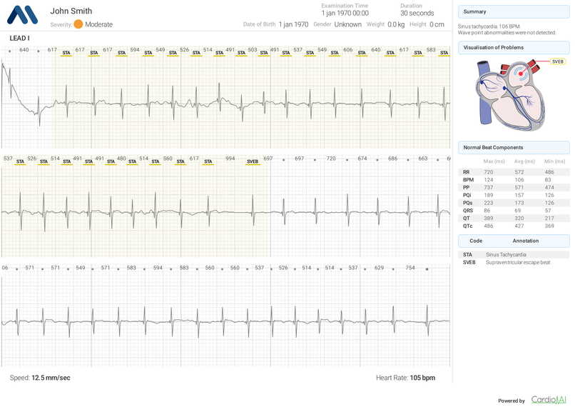 Cardio.AI – screenshot 2