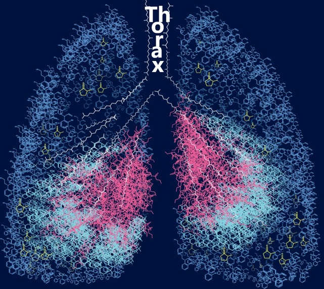 Thorax : a life saver. – screenshot 4