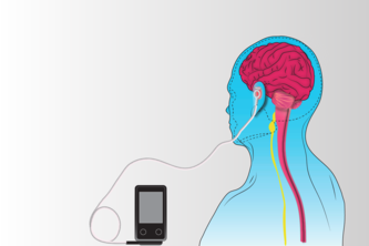 vagus nerve stimulation for cytokine storm in COVID-19