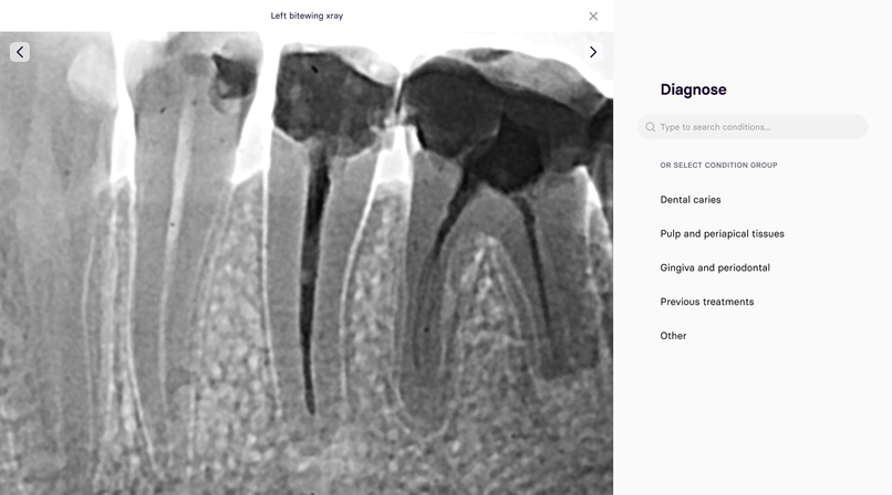 Denther – screenshot 4
