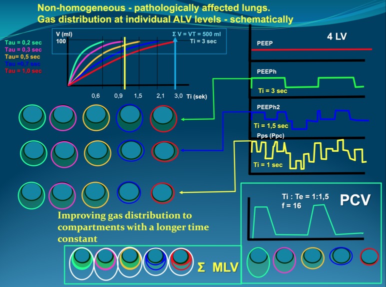 Simulator for training in advanced lung ventilation – screenshot 1