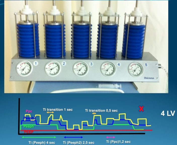 Simulator for training in advanced lung ventilation – screenshot 2