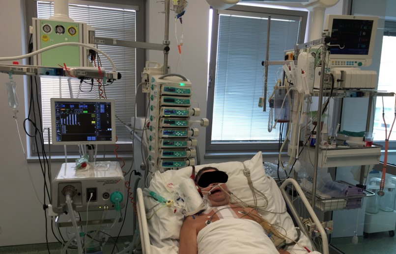 Simulator for training in advanced lung ventilation – screenshot 3