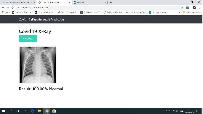X-Ray image analysis – screenshot 4