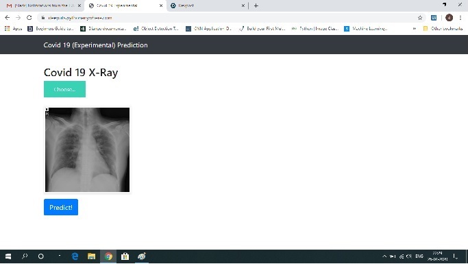 X-Ray image analysis – screenshot 2