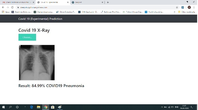 X-Ray image analysis – screenshot 3