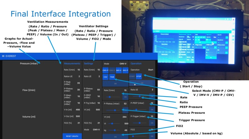 EVEREST - Easy Ventilator for Emergency Situations – screenshot 3