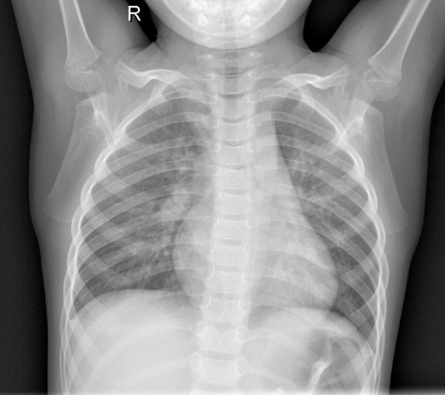 X-Ray COVID – screenshot 2