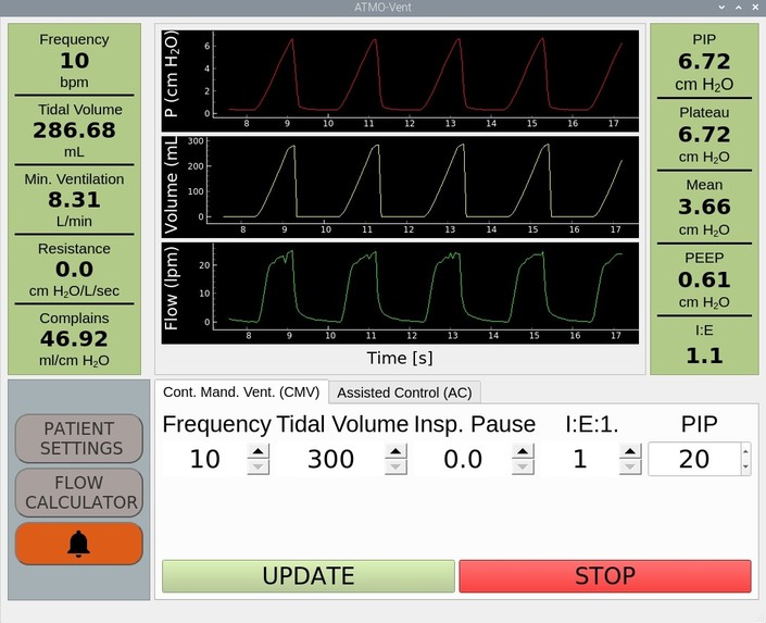 ATMO-Vent – screenshot 7