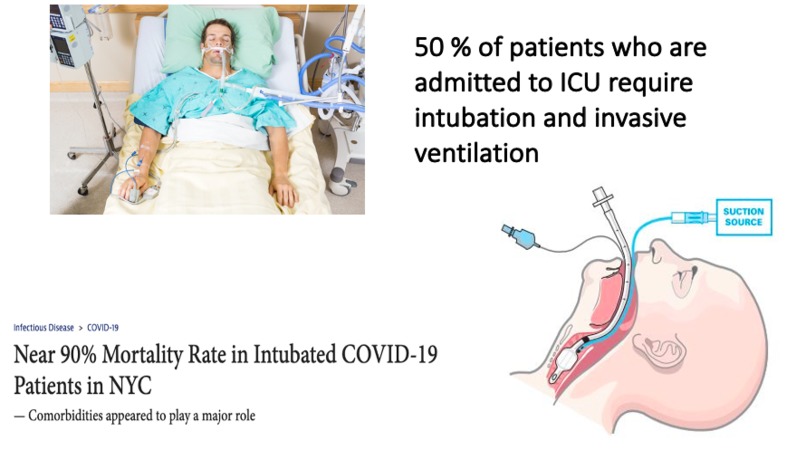 3D printed endotracheal tubes for local drug delivery – screenshot 2