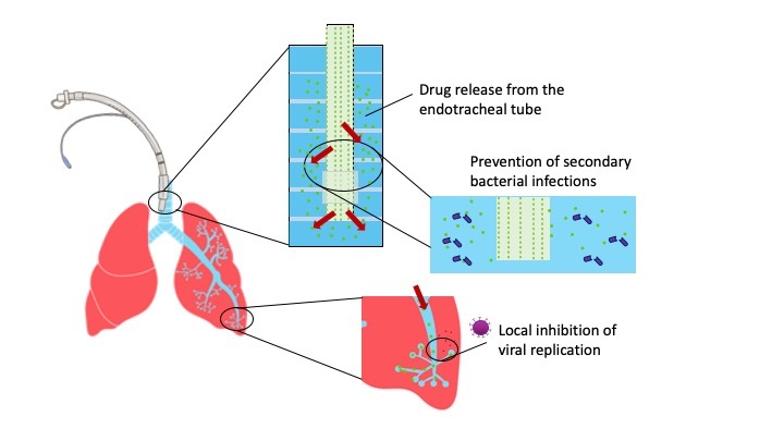 3D printed endotracheal tubes for local drug delivery – screenshot 1
