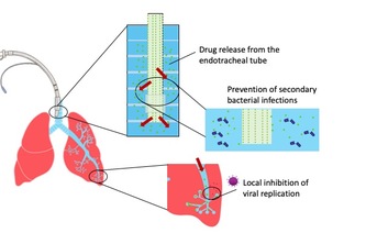 3D printed endotracheal tubes for local drug delivery