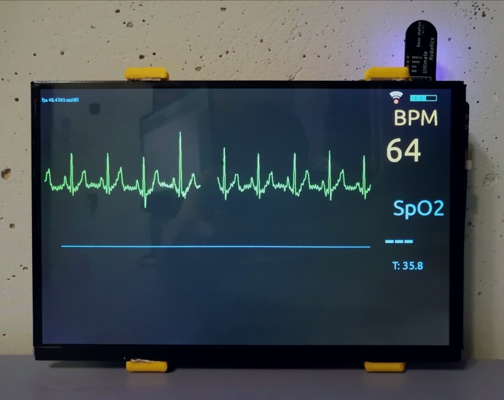 Open source patient monitor – screenshot 3