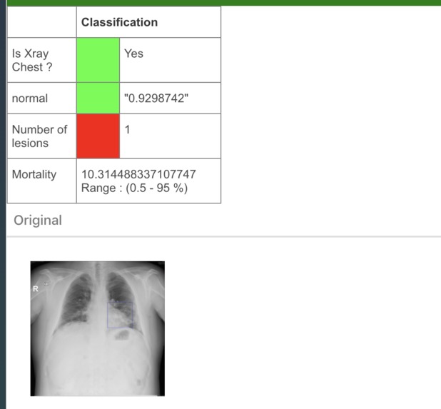 MantisCOVID : Rapid X-Ray/Mortality Rate Evaluation Platform – screenshot 3