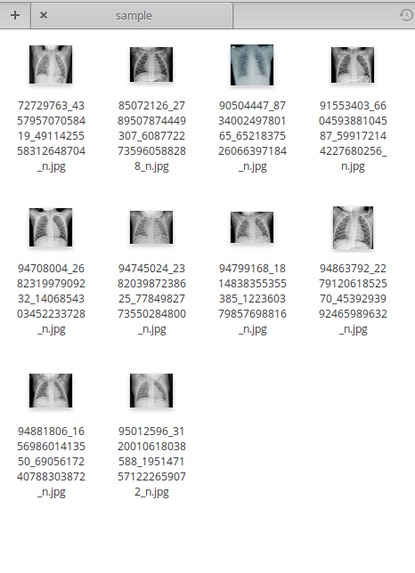 X-Ray COVID – screenshot 3