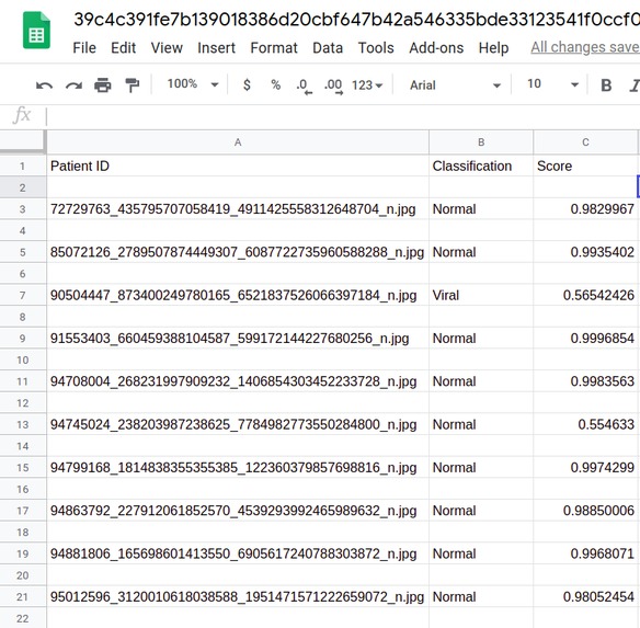X-Ray COVID – screenshot 5
