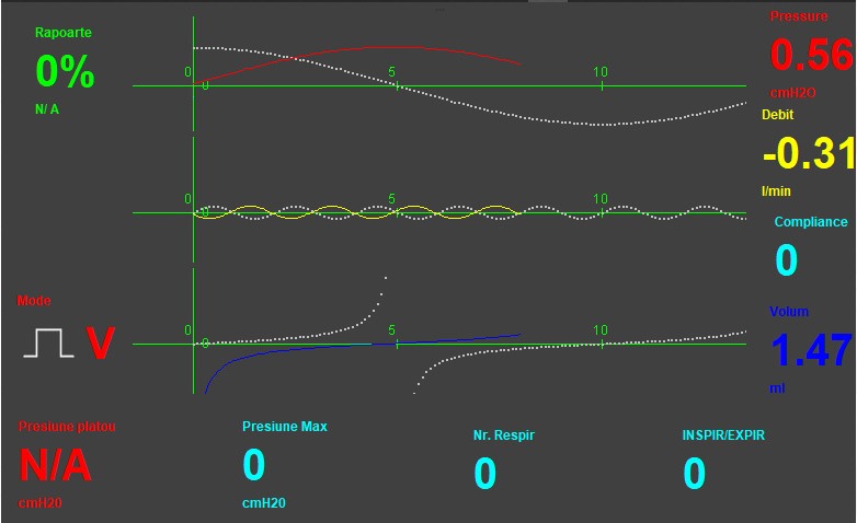 VentilaThor@RISE – screenshot 1