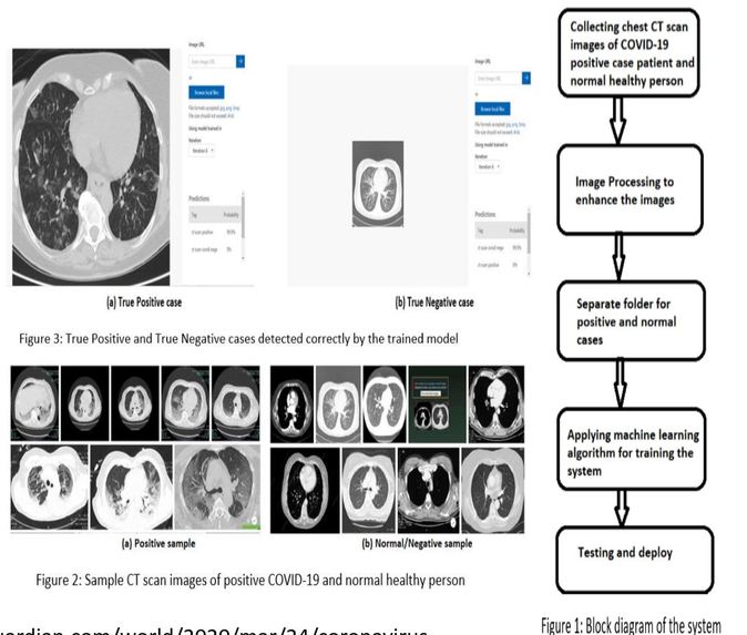  Accurate Diagnosis of COVID-19 Using CT Scan and AI – screenshot 4
