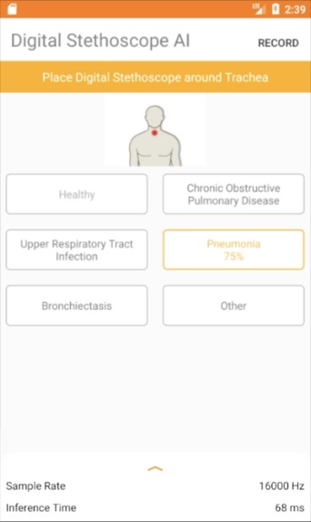Digital Stethoscope AI – screenshot 2